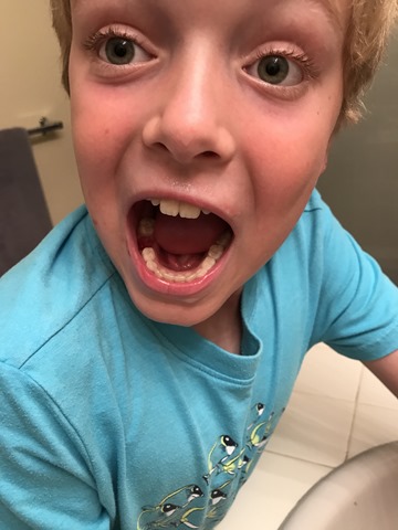 20170916_190749374_iOS